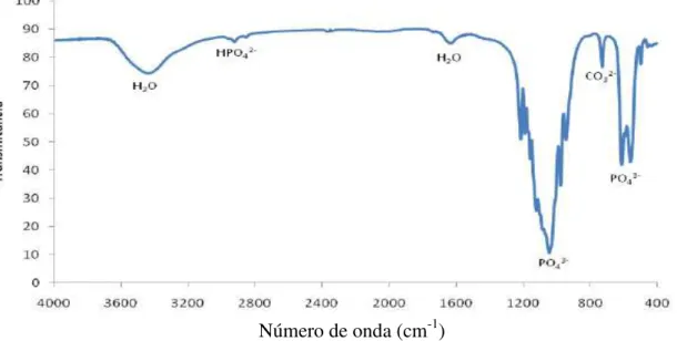 Figura 2.7.3. Espectrograma de FT-IR de pó de trifosfato de cálcio tratado a 1000ºC