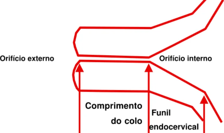 Figura 1 - Medidas usadas para avaliação do colo uterino pela ultra-sonografia transvaginal.