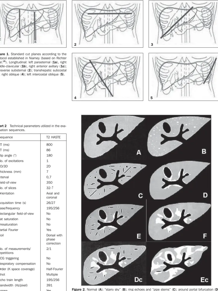 Figure 1. Standard cut planes according to the protocol established in Niamey (based on Richter et al