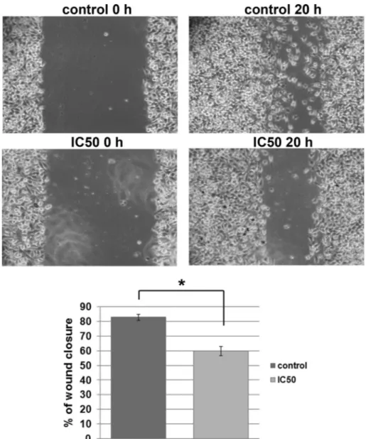 Fig. 3. Effect of M. giganteus extract on migration of HeLa cells (wound-scratch migration assay)