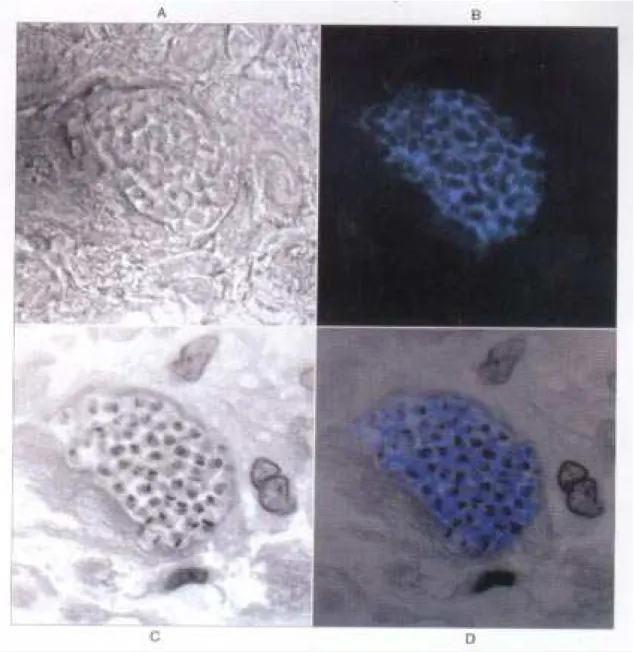 Figure 1 - Confocal imaging of myocardial tissue from Chagasic patient: A: Nomarski or differential interference contrast image of amastigote nest amongst cardiac myofibers