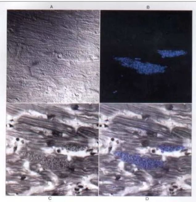 Figure 2 - Confocal imaging of myocardial tissue from chagasic patient: A: Nomarski or differential interference contrast