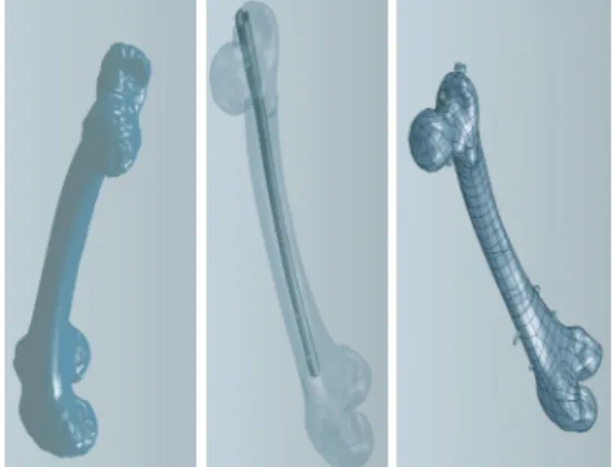 Fig. 8  Modelo CAD: fémur, fémur-implante e fémur- fémur-implante-parafusos. 