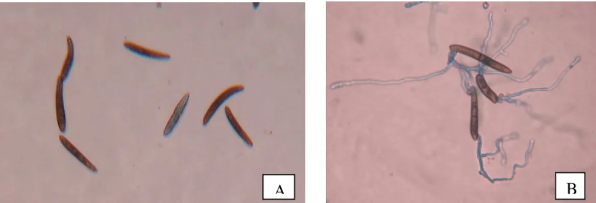 Figura 3 -  Conídios de Stenocarpella  macrospora não germinados (A) e conídios germinados (B)