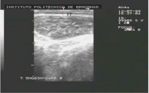 Fig. 1. Ultrasound image collect procedure.
