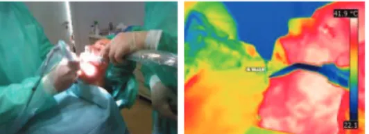 Fig. 2 – Blocos da Sawbones (C+D,C-D,T+D,T-D).