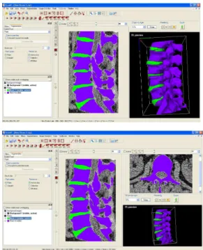 Fig.  1  Visualizações  do  pré-processamento  de  imagens  efectuado no software ScanIP
