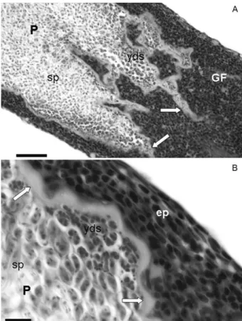 Fig. 2: light photomicrographs of histological section of gill filaments  (GF) of Brycon hilarii parasitized by Myxobolus oliveirai sp