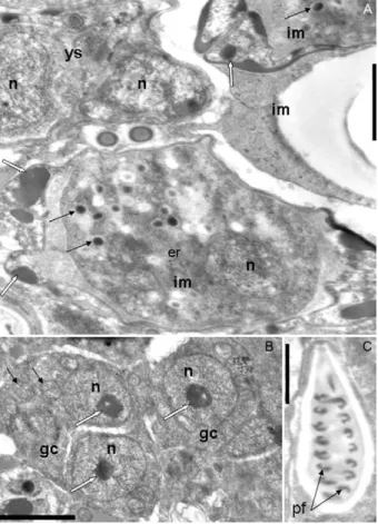 Fig. 3: electron micrographs of Myxobolus oliveirai sp. nov. parasite  of gill filaments in Brycon hilarii