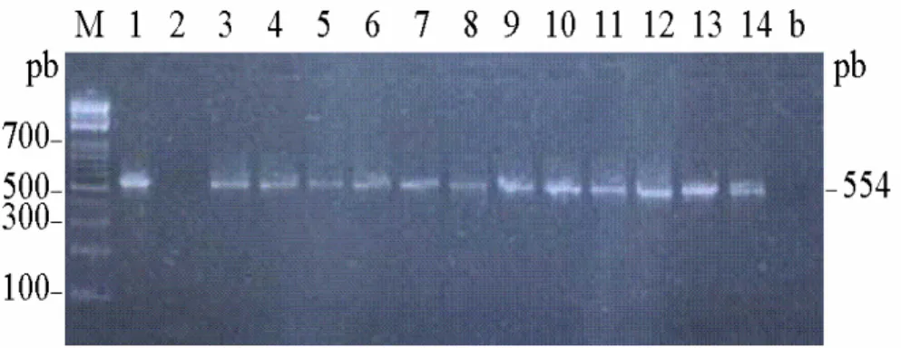 Figura 4. Eletroforese em gel de agarose 1,5% dos produtos de amplificação originados a partir dos diferentes  oligonucleotídeos construídos neste trabalho