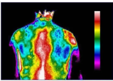 Figura 12 - Comparação bilateral das temperaturas na região dorsal do corpo. 
