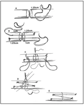 Figura 22 - Técnica sutura Tsai        Fonte: Adaptado de Severo (2005) 