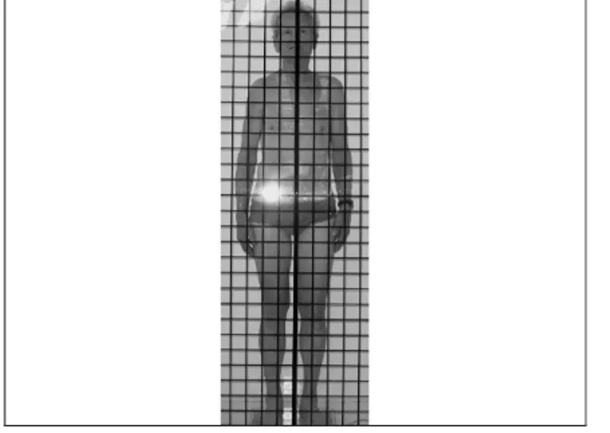 FIGURA 1 – Exame postural: imagem do plano coronal, vista anterior do tri-atleta idoso 