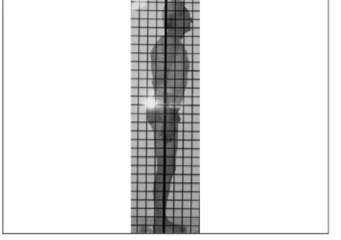 FIGURA 3 – Exame postural: imagem do plano sagital, vista lateral direita do tri-atleta idoso 