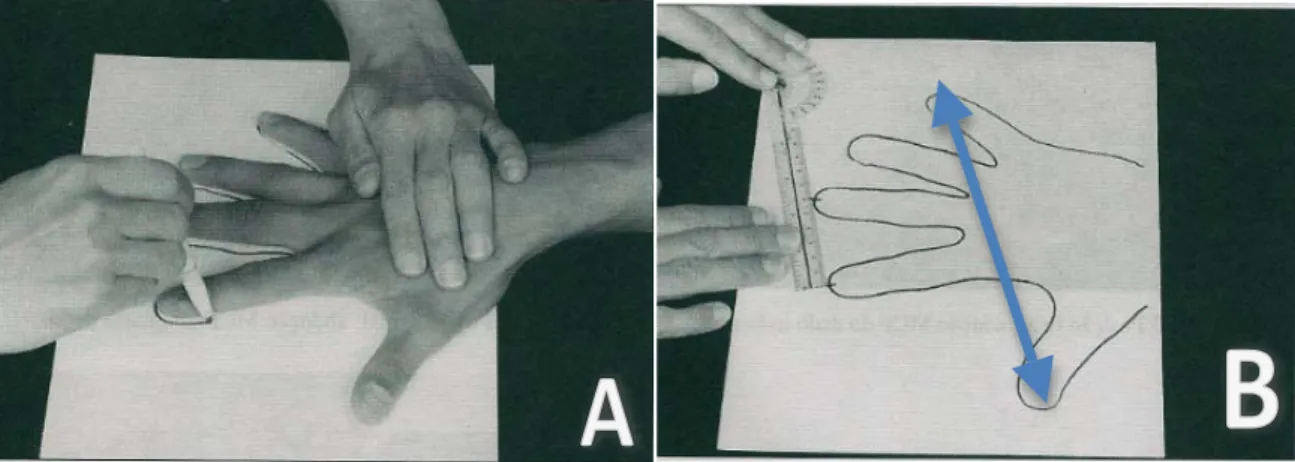Figura 4 - A: Traço da mão para mensuração do comprimento transversal ou abertura da mão