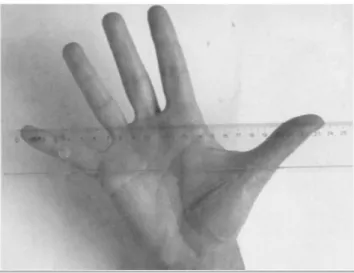 Figura 5 - Comprimento transversal da mão (Fonte: RUIZ-RUIZ, 2002) 