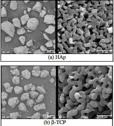 Figura I.18. Morfologia e microestrutura dos grânulos de  hidroxiapatita e fosfato de cálcio-β obtidos da sinterização a 1100ºC/2h  