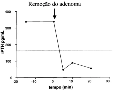Figura 2. Níveis de PTH intacto sérico ao longo de cirurgia curativa em paciente portador de adeno- adeno-ma de paratiróide e hiperparatiroidismo primário.