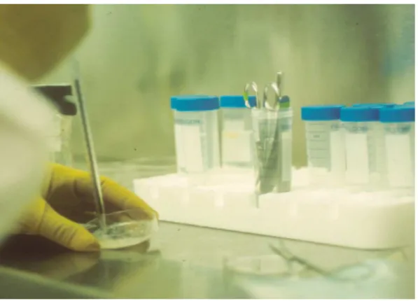 FIGURE 3  – Fragments and trypsin aspiration. 