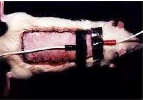 FIGURE 4 -  Electrodes were placed at the base  of  the  flap  for  the  transcutaneous  electrical  nerve stimulation