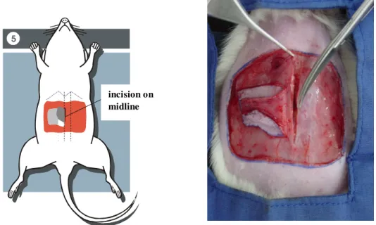 FIGURE 5  - Drawing and photography that shows the incision along the linea alba to  elevate the flap