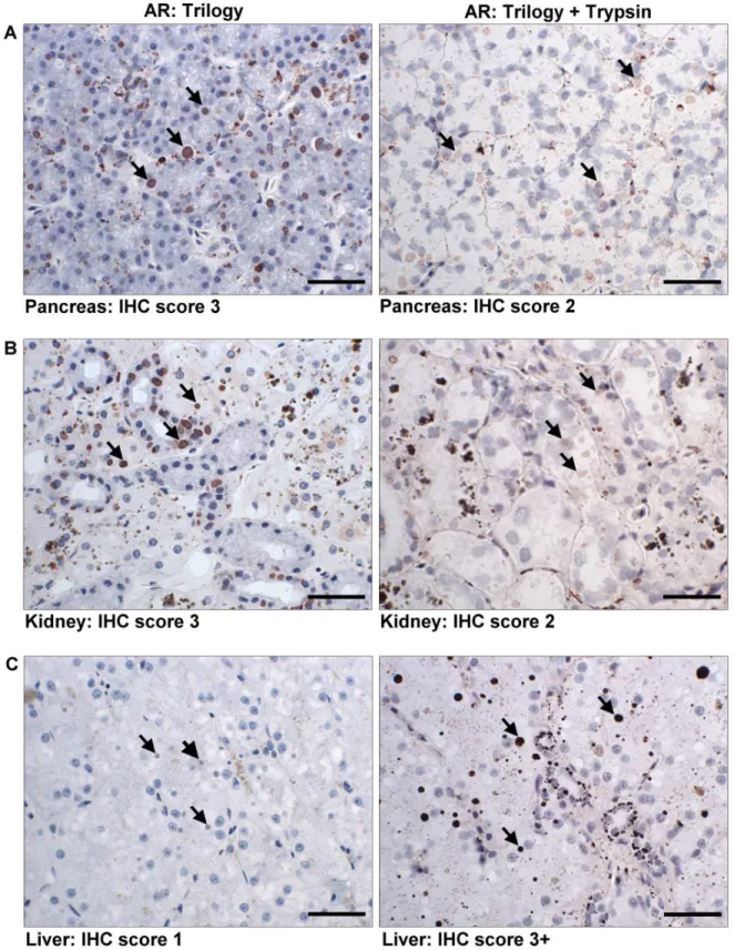 Figure 7.  Differences in IHC staining between Trilogy and double AR treatment on prolong fixed tissues