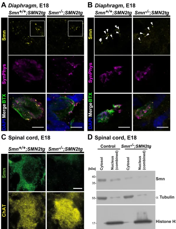 Figure 7. Smn deficiency in SMA type I axon terminals in vivo. (A, B) Representative motor endplates from E18 Smn +/+ ; SMN2tg and Smn 2/2 ; SMN2tg Diaphragm stained against Smn and SynPhys