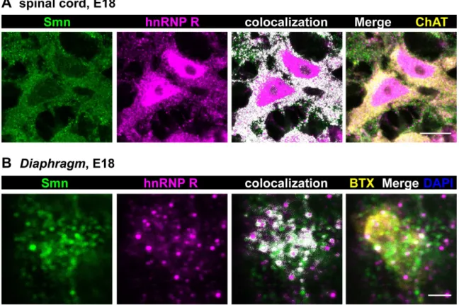 Figure 5. Colocalization of Smn and hnRNP R in vivo in E18 motoneurons and axon terminals