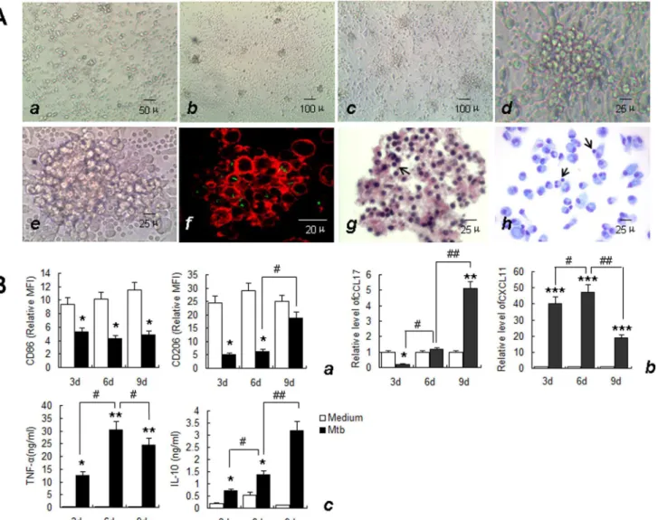 Fig 3. Characteristics of in vitro tuberculous granuloma model and the expression of granulomatous macrophage markers