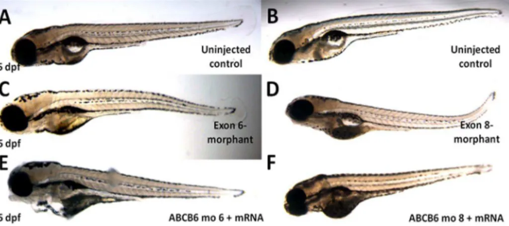 Figure 3. Phenotypes of the microinjected zebrafish. Morpholinos against exon 6 and exon 8 of zABCB6 and wildtype zABCB6 mRNA transcript (in case of rescue) were designed and injected into one- to two-cell stage embryos