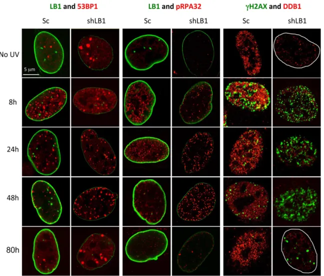 Figure 5. Silencing LB1 expression in U-2 OS cells dramatically delays detection and repair of DNA damage induced by UV