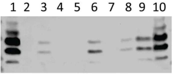 Figure 8. Mouse i.n. infection model showing the effects of ciaRH and licD 2 mutation on their abilities to cause invasive disease.