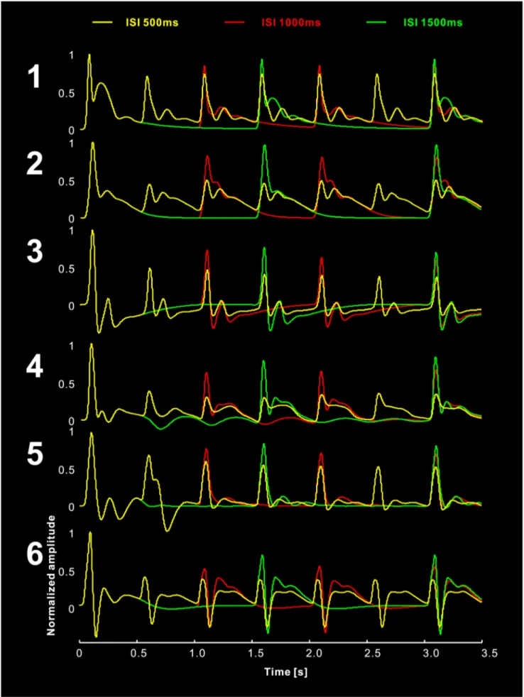 Figure 9. Simulated data using variable inter-stimuli interval (ISI) (500 ms, 1000 ms, and 1500 ms).
