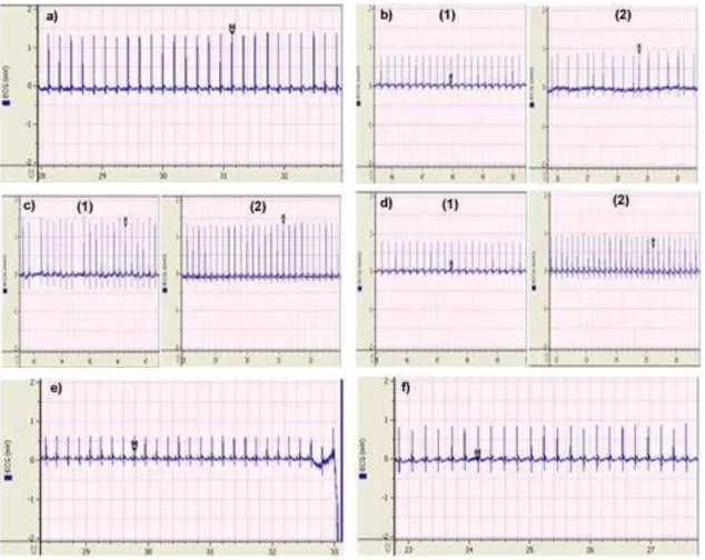 Fig. 2: ECG patterns of rats with brady-arrhythmia induced by KCl .  Groups a) Absolute control, b) Positive control, c) Curative, d) Standard drug (e)  Baseline and f) Preventive.