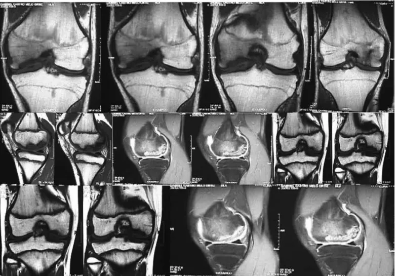 Figure 1 – Preoperative magnetic resonance imaging.