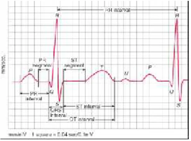 FIG. 4. ECG Waveform 