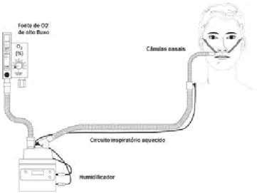 Figura 1: O circuito das CNAF com os seus 4 componentes  (adaptado de Nishimura M, High-flow nasal cannula oxygen  the-rapy in adults
