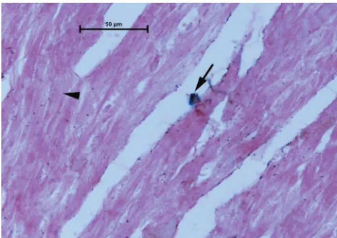Figure 5. Photo micrograph of Sham group. Note: Myoi- Myoi-brils (arrowhead) and iron accumulation (arrow) are seen  (Perls’  Prussian  blue  staining,  original  magniication  X  40).