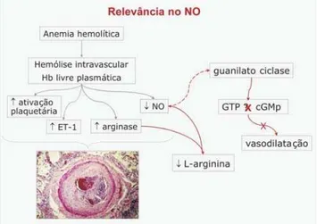 Figura 1. Relevância do óxido nítrico (NO) na fisiopatologia do fenômeno vaso-oclusivo, adaptado de Rother  et al ., 2005