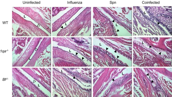 Fig. 4. Representative H&amp;E-stained middle ear sections. Middle ear inflammation on day 3 after Spn infection in WT, C1qa 2 / 2 , and Bf 2 / 2 mice infected with IAV or either pathogen alone