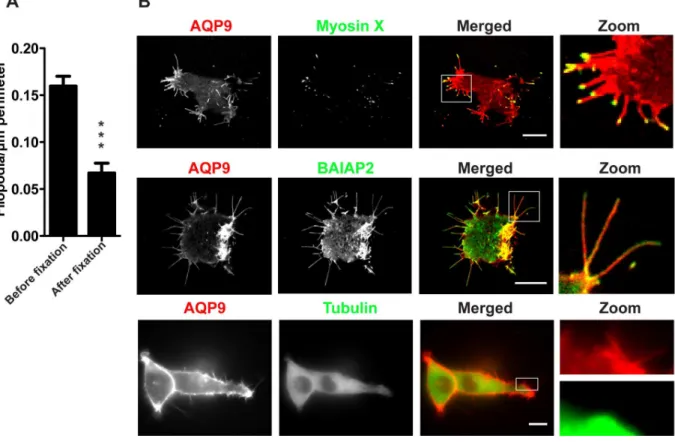 Figure 2. Localization of tubulin, myosin X and BAIAP2 in GFP-AQP9-transfected HEK-293 cells