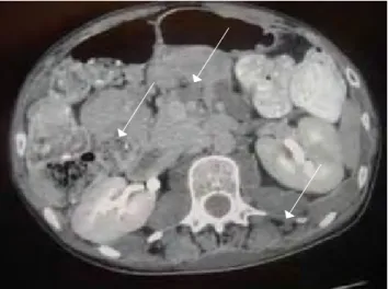 FiG. 1 FiG. 2