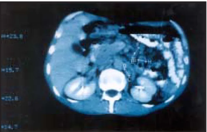 Fig. 3 - Vilosidade Intestinal