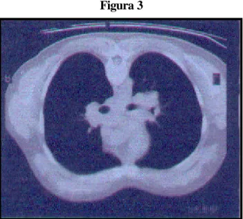 Figura 2 Figura 3