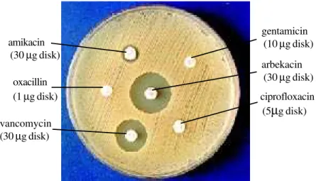 Figure 2. ORSA isolate showing in vitro susceptibility only to arbekacin and vancomycin
