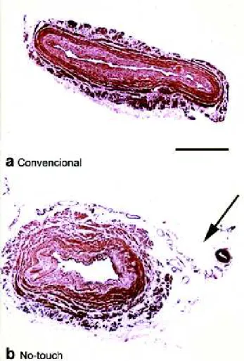 Fig. 4 - Contents of the collagen at the point of the saphenous vein.