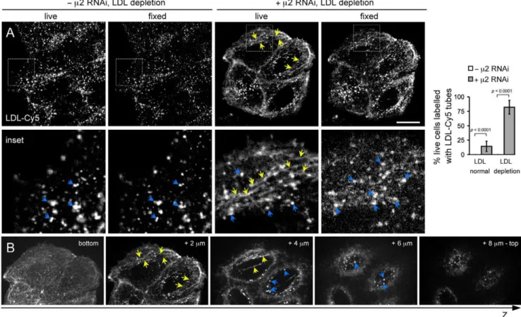 Figure 7. Enrichment of endocytic tubules labeled with LDL-Cy5 in HeLa cells depleted of AP-2 and LDL and their susceptibility to chemical fixation