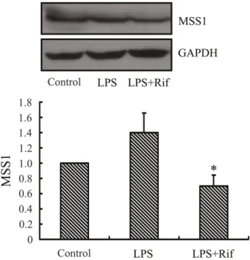 Figure 3. MSS1 gene knockdown reduced the expression of MSS1 at protein levels. In order to assess the efficacy of gene silencing, western blot analysis was performed after transfection with siRNAs targeting MSS1