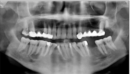 Figure 15. Panoramic radiograph at the end of 2 year follow-up period shows no  signs of the recurrence (Case 3).