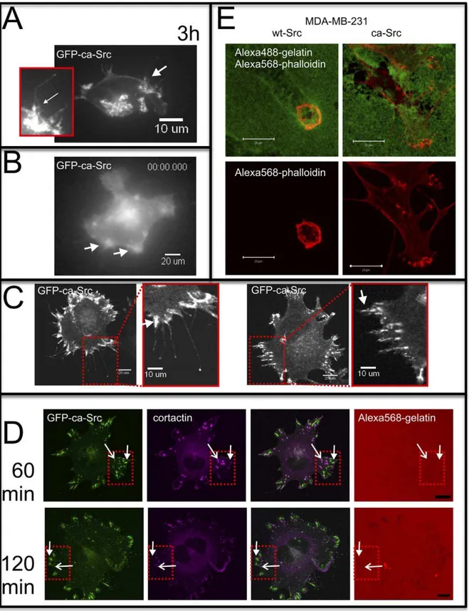 Figure 2. Localization of GFP-ca-Src at the plasma membrane and in focal adhesions and invadopodia core complexes associated with matrix degradation